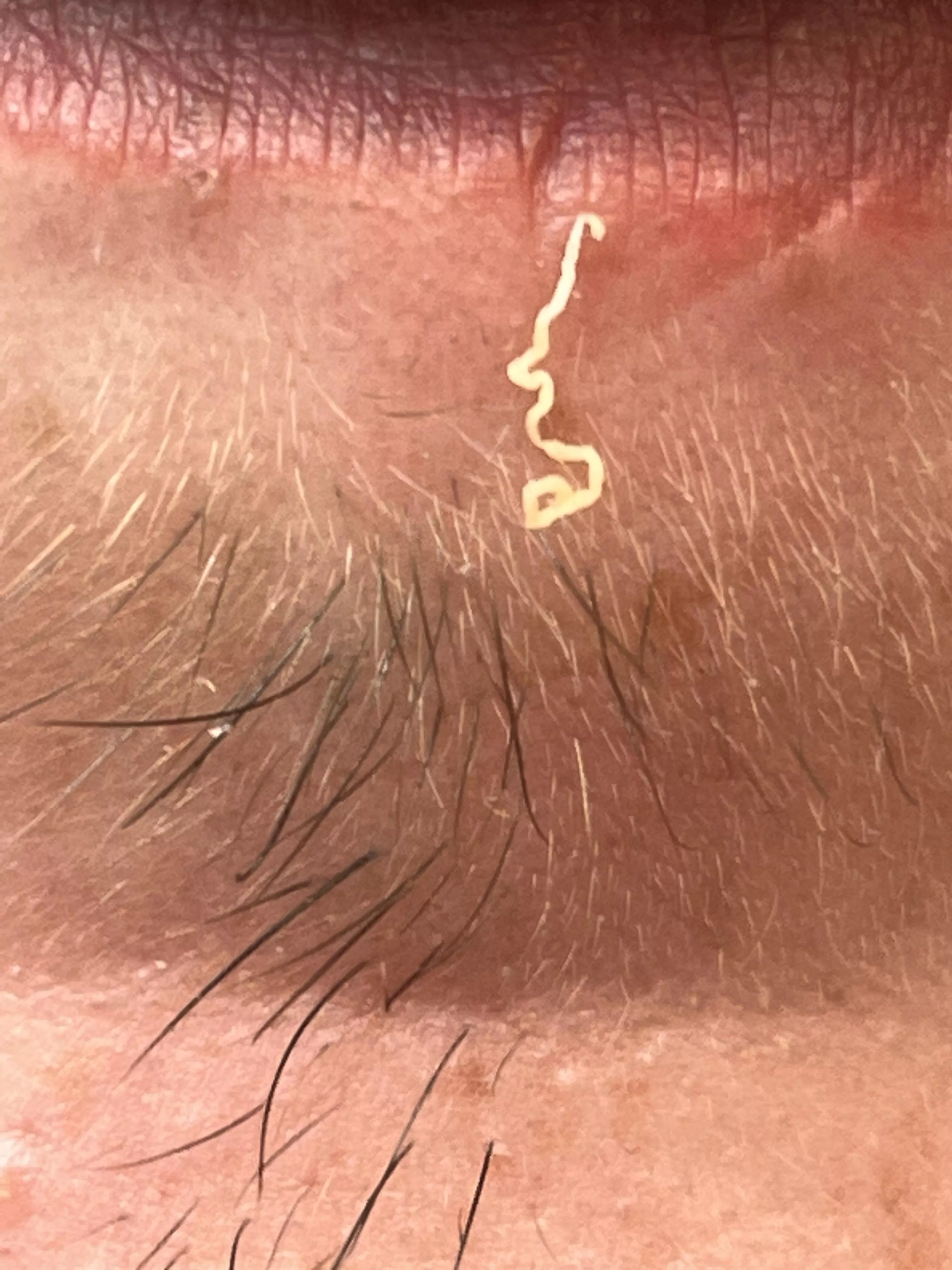 Satisfiying pop on lower lip