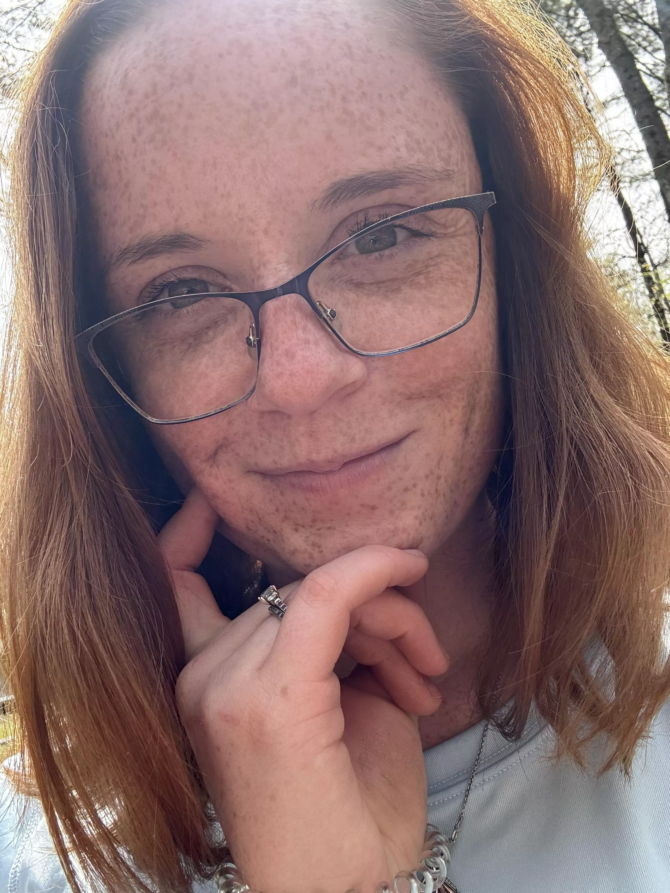 [IRTR] freckles in the sun!