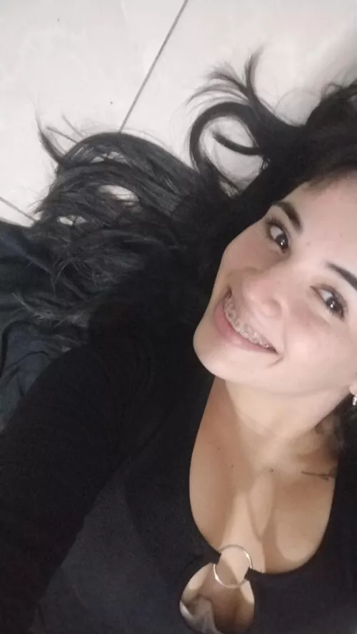 my smile with braces becoming more and more perfect to be able to kiss your member