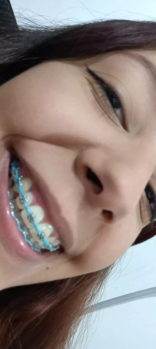 My teeth are very clenched😳