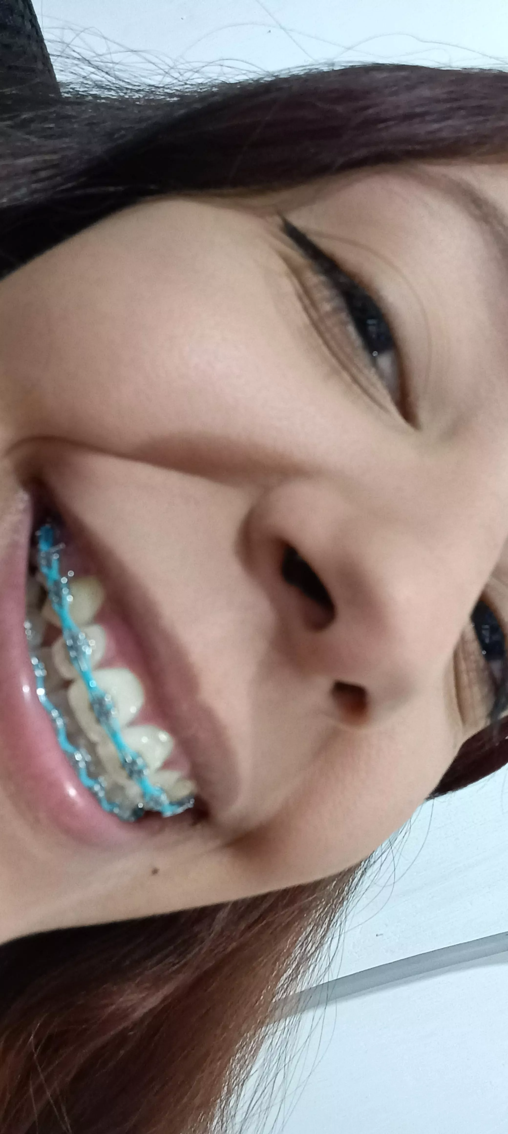 My teeth are very clenched😳