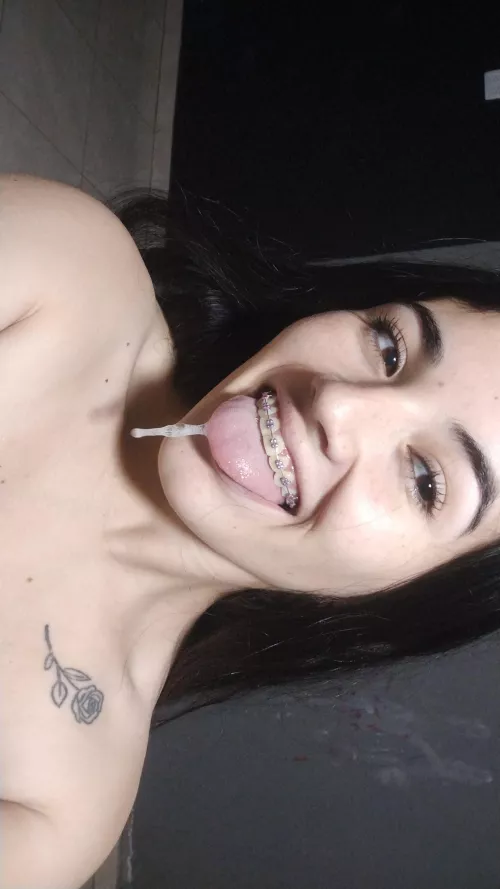 Now I understand why they like slime on braces.