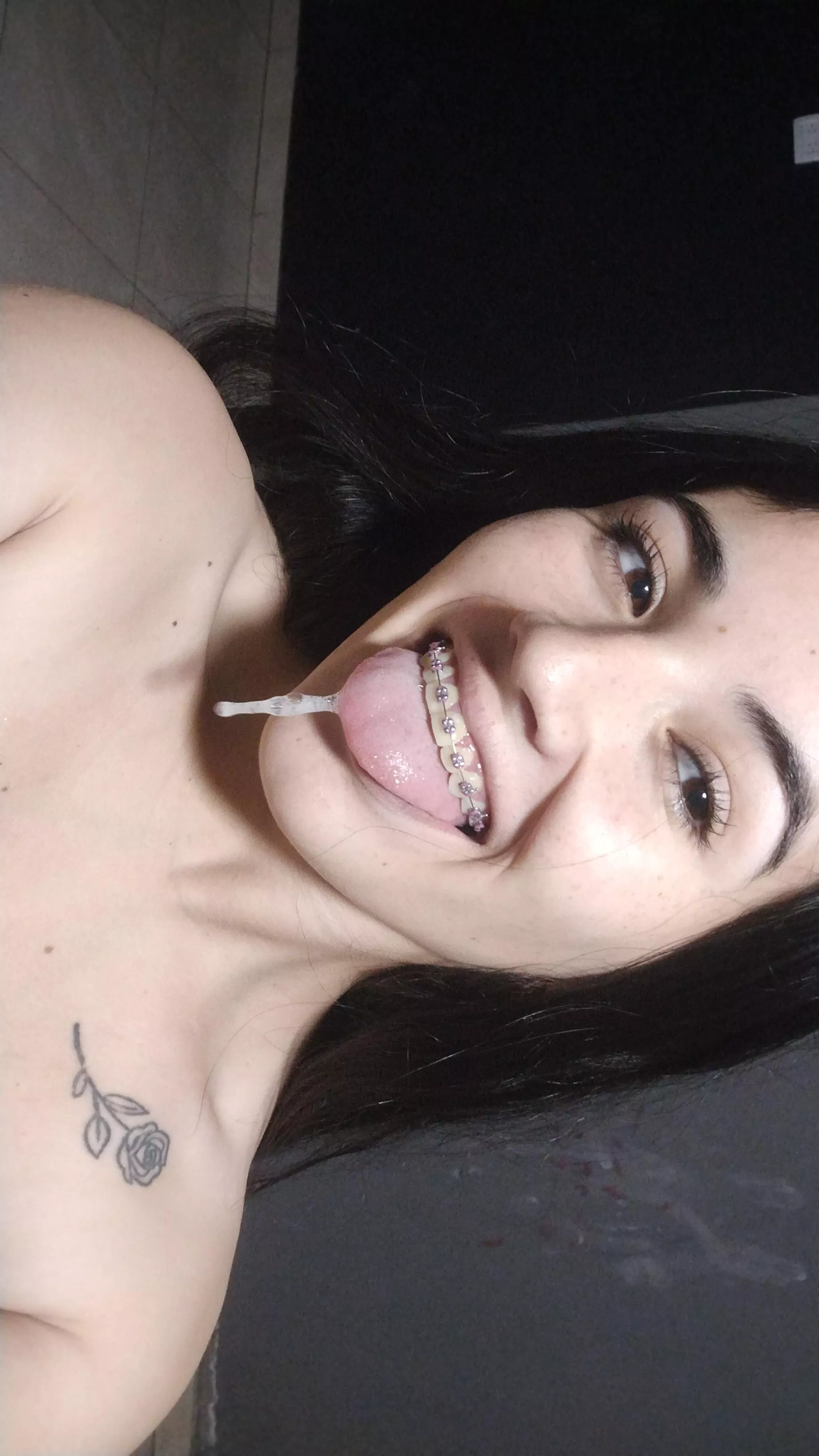 Now I understand why they like slime on braces.