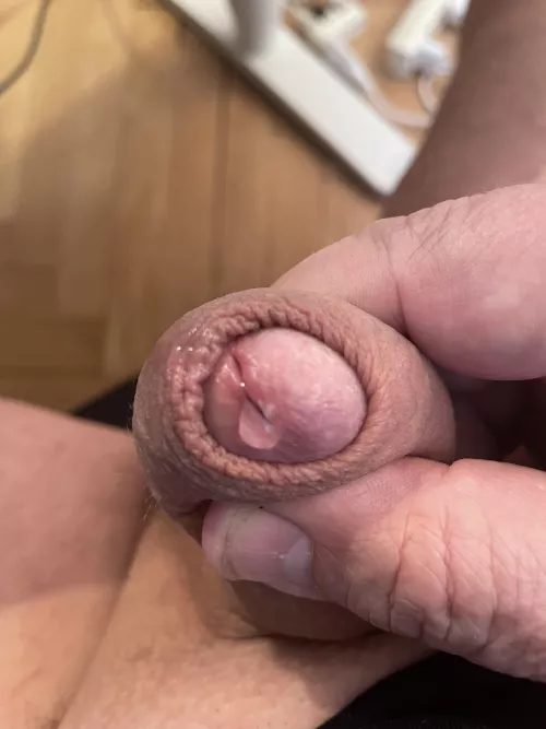 any guys wanna slide my foreskin?