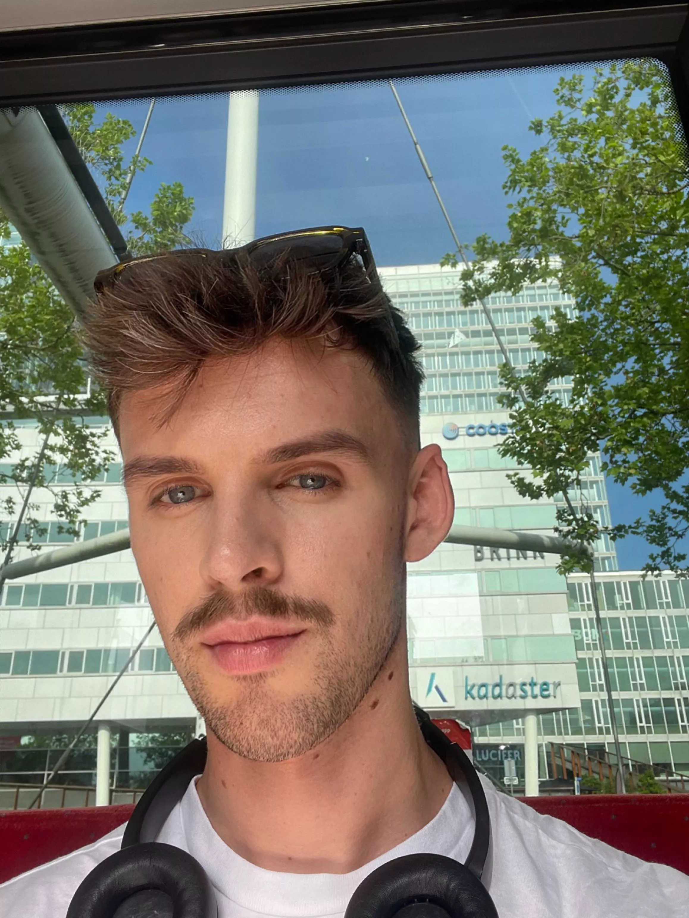 I’m about to turn 29, and I’m graying