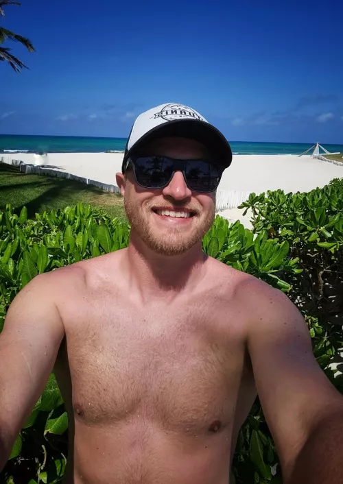 Totally worth the massive sunburn! Help me with the aloe? 😅