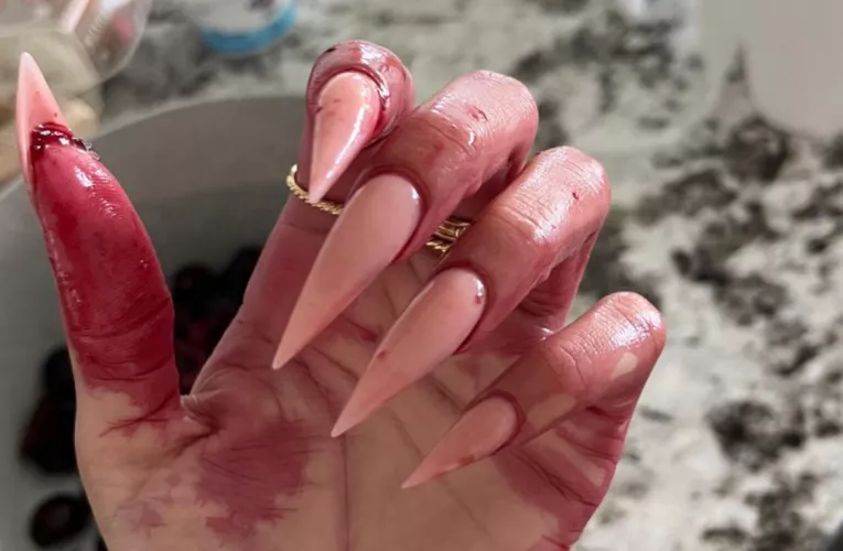 Scratched you so bad that you start bleeding. Any volunteers?