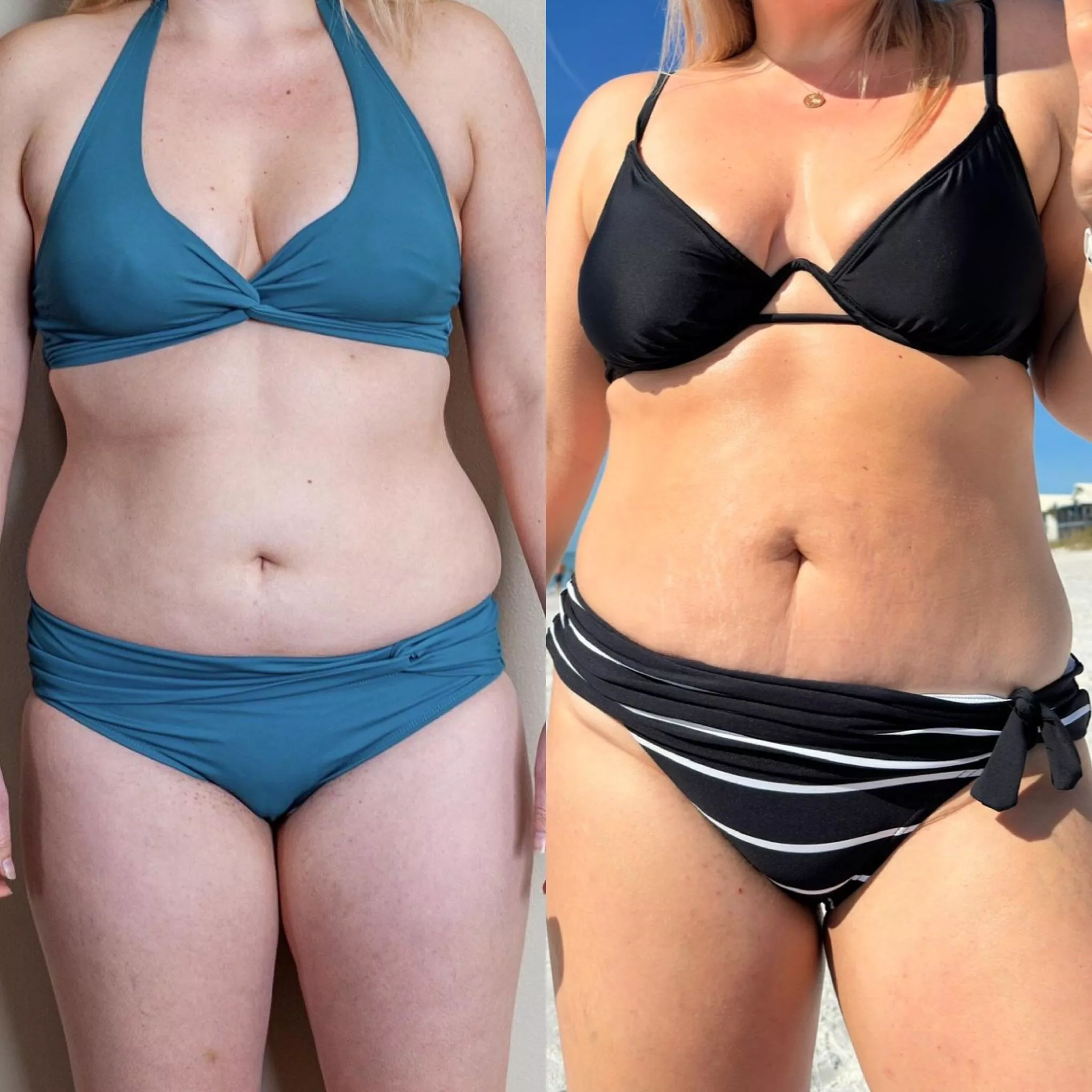 Wife wants to know if she is better at 26 on the left or 36 on the right?