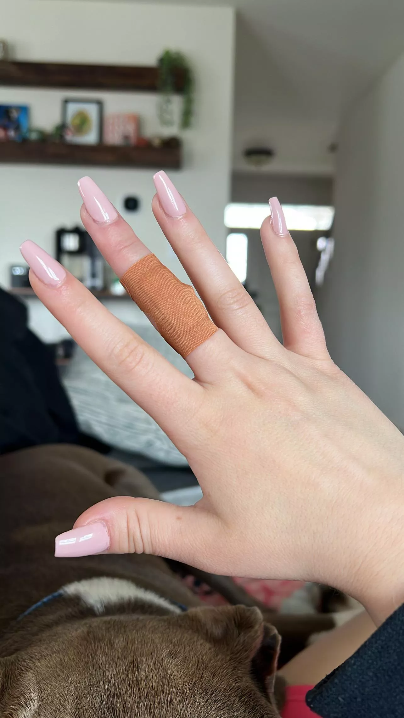 I got an ouchy. Please send kisses and tips 😈