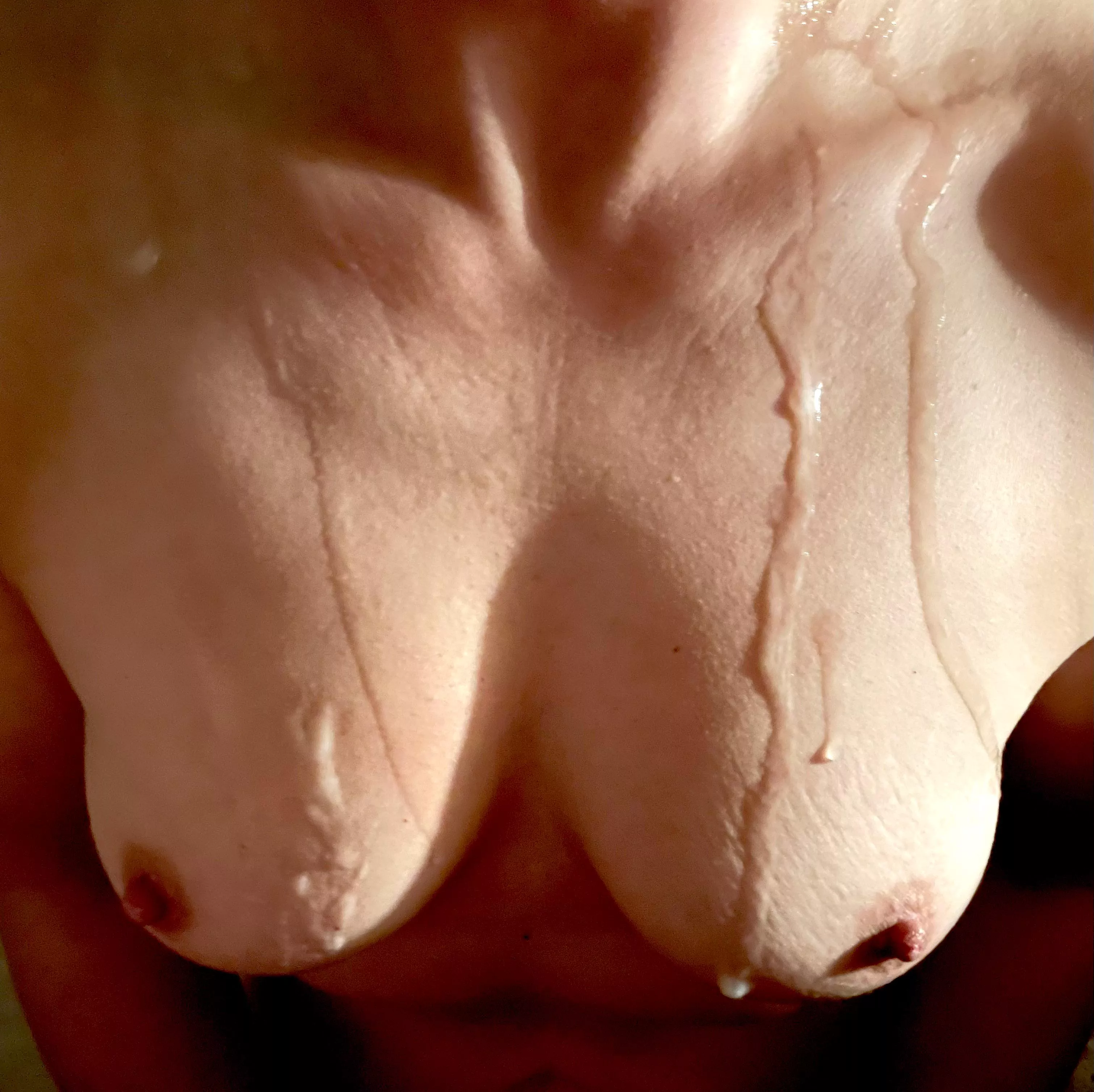 Those drips…