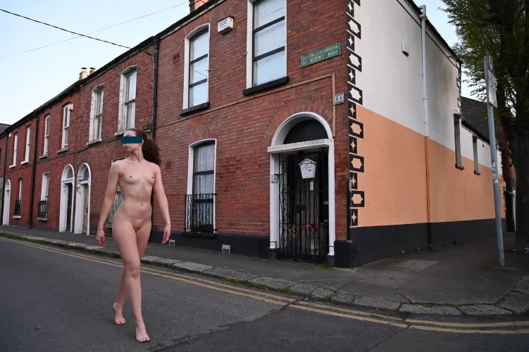 I’ve never been embarrassed of my skin, even in public