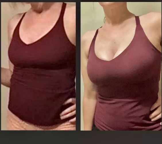 2022 vs. now 💖 No surgery. Just a 40(f) mom getting her hormones and boobs back. See you at soccer ⚽️😋