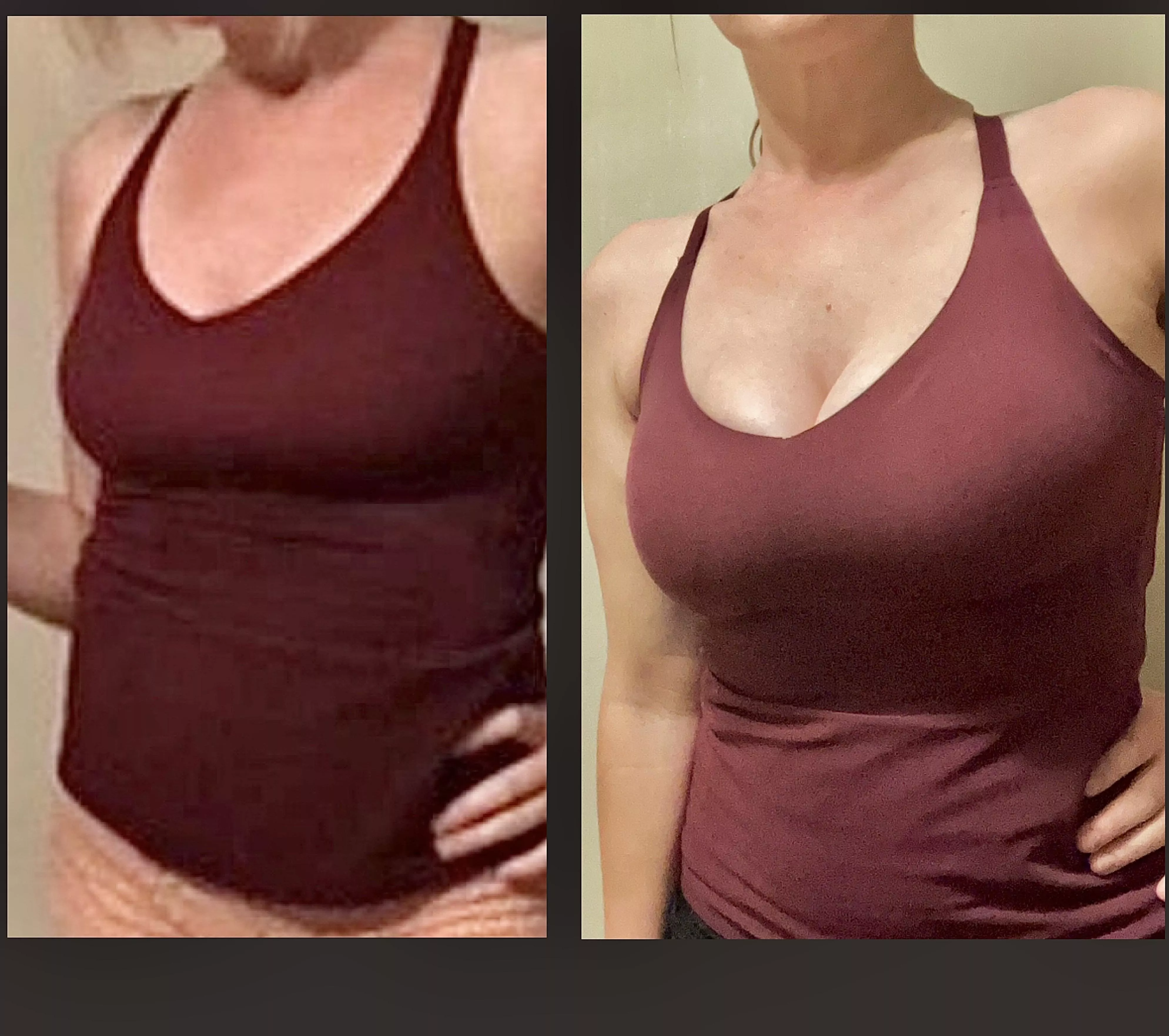 2022 vs. now 💖 No surgery. Just a 40(f) mom getting her hormones and boobs back. See you at soccer ⚽️😋