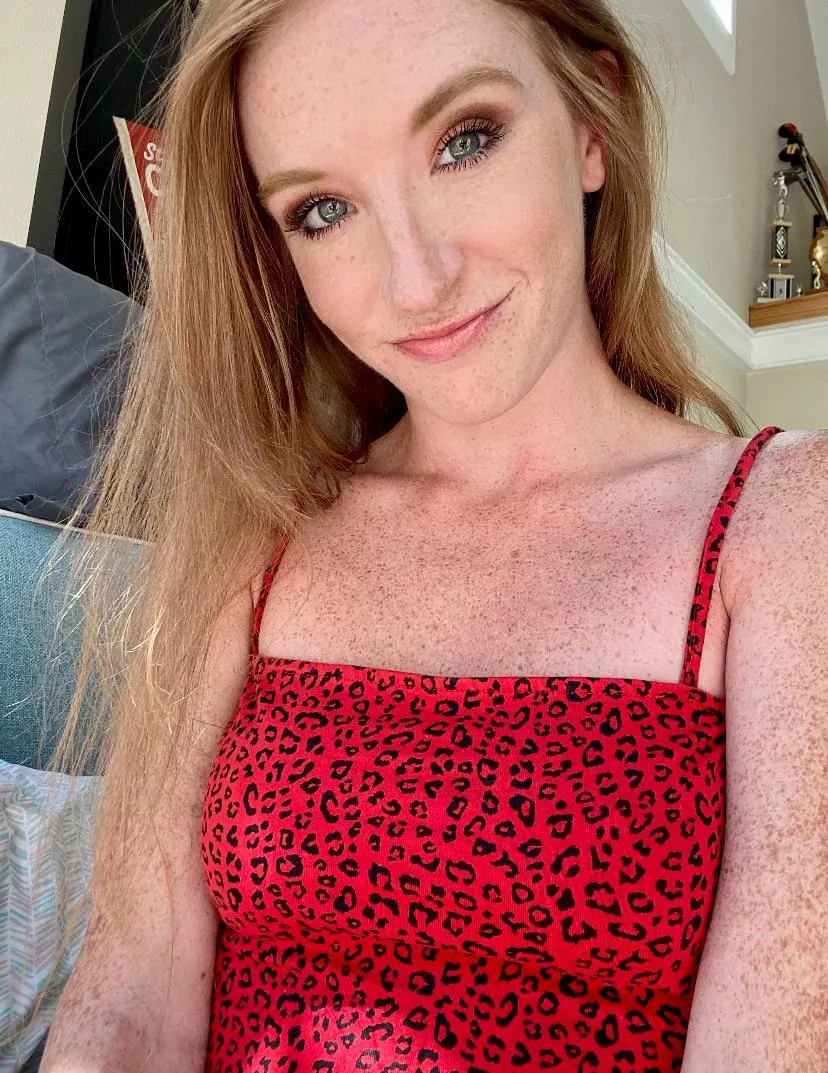 Have you seen someone with too many freckles [IRTR]