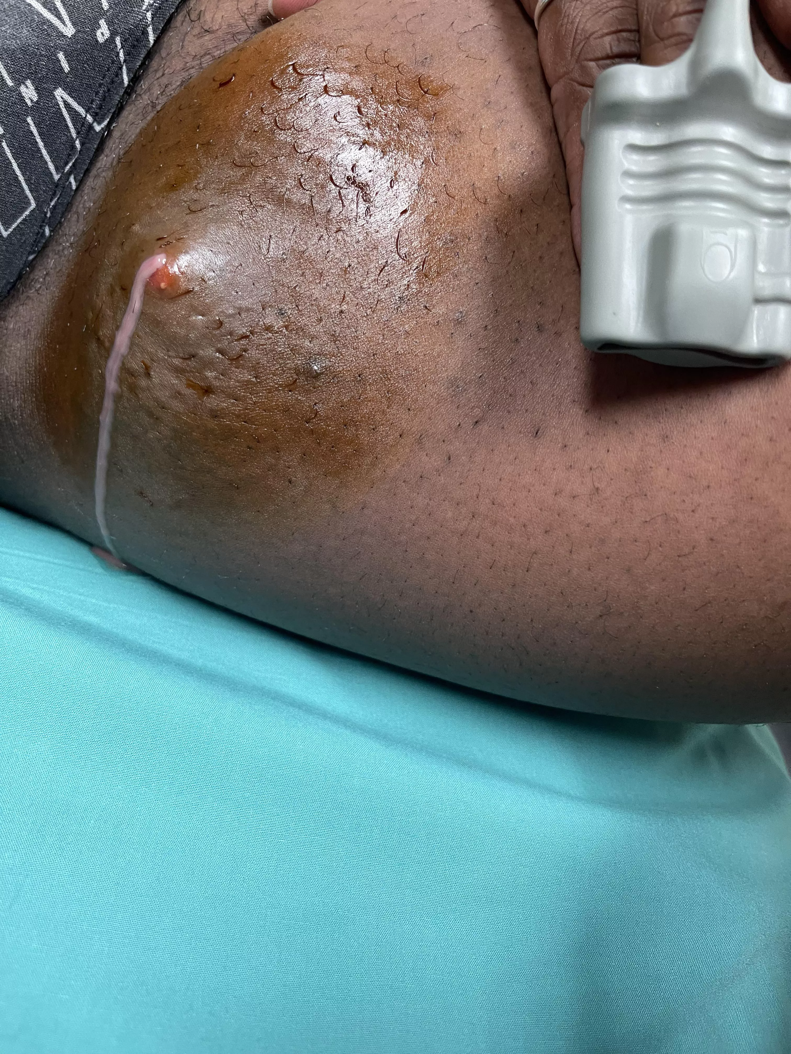 My sister said I can post this here