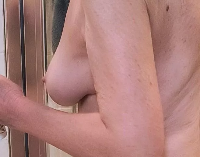 71 year old comments?