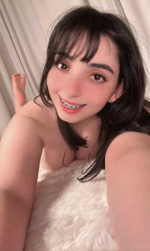 I have freckles everywhere, but they seem to like to hang out on my face the most