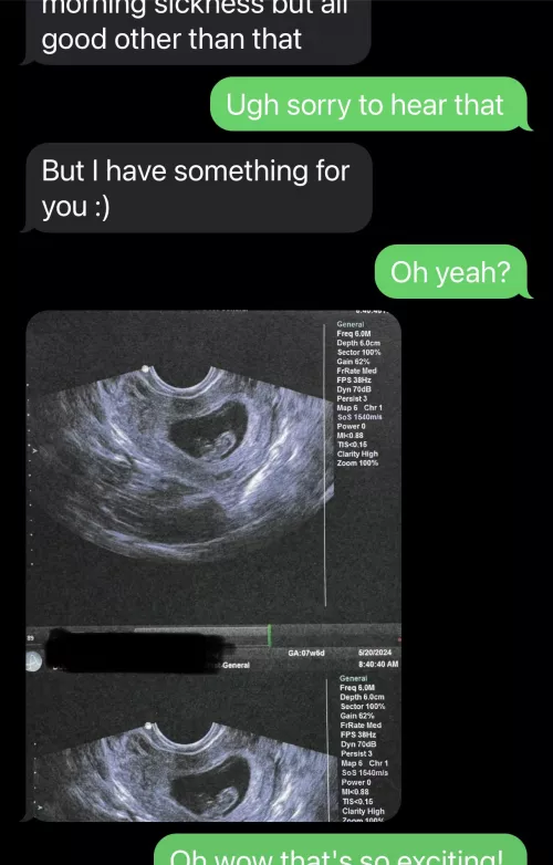 My second breeding is coming along