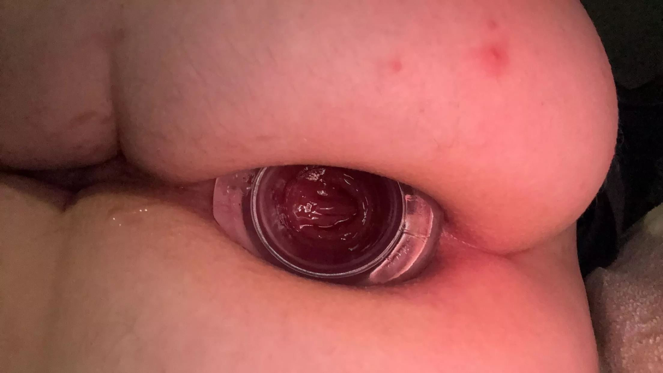 Can someone come replace this with a fist already (19)