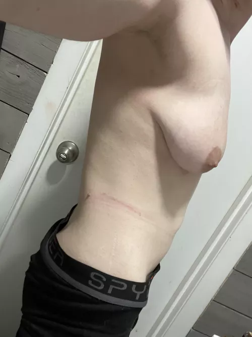 Postbondage rope burns are something new I’ve been dealing with