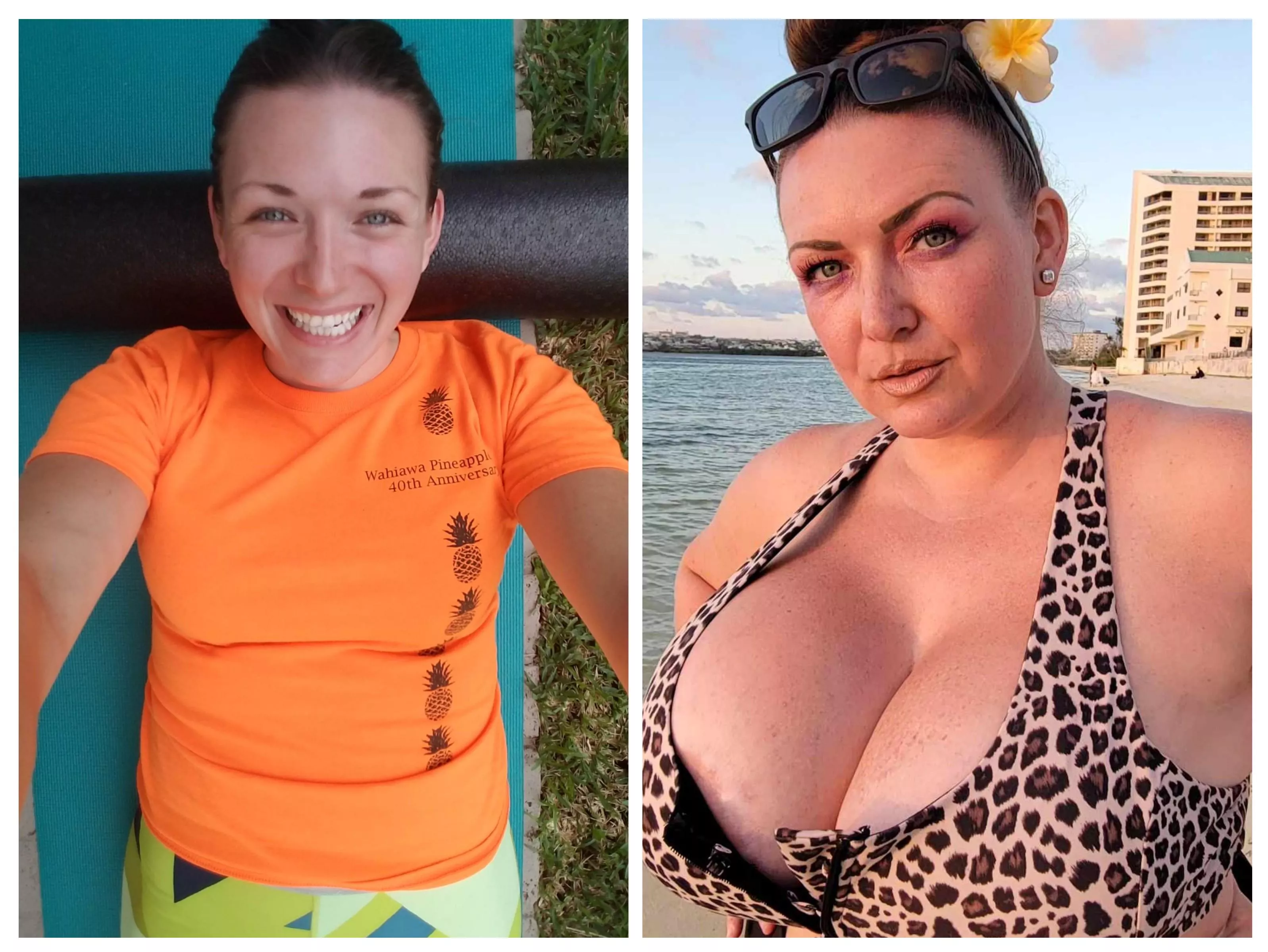 Flat to Full My 4-Year Transformation with 2500cc Implants. Going bigger 24 days!