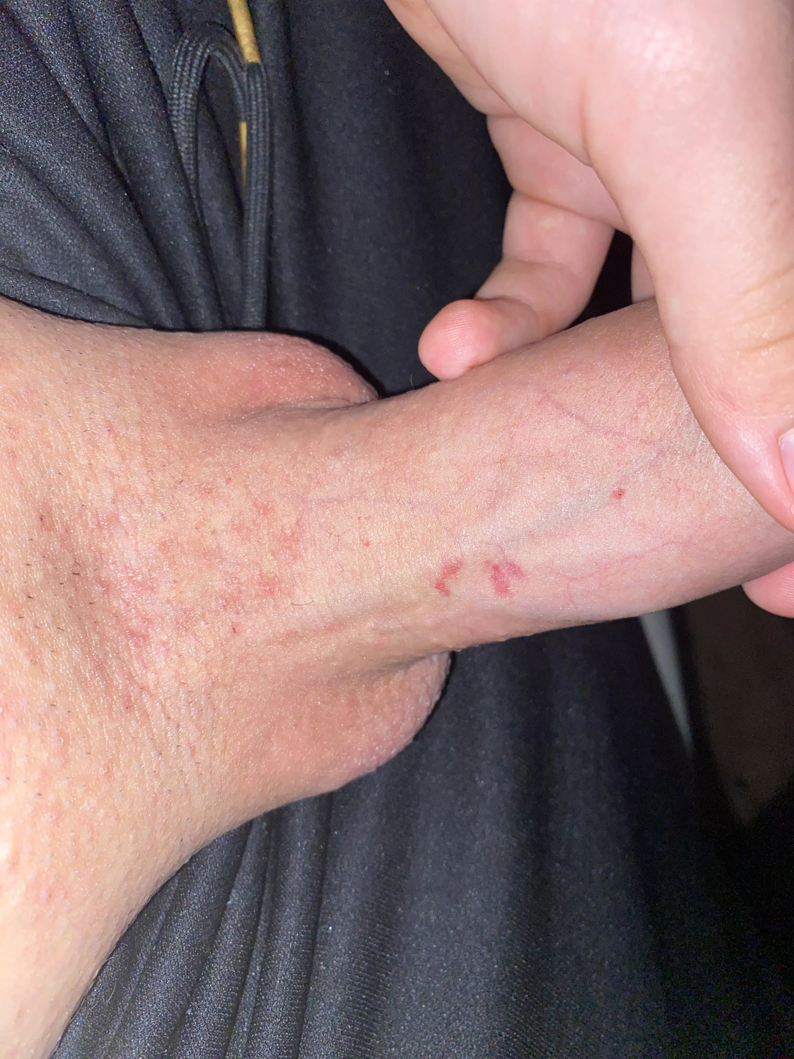 Pumped my cock and this popped up , what did I do wrong 