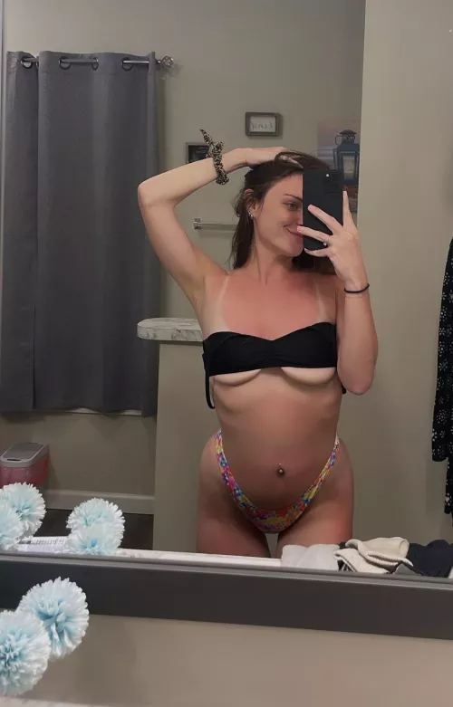 Sunburnt 