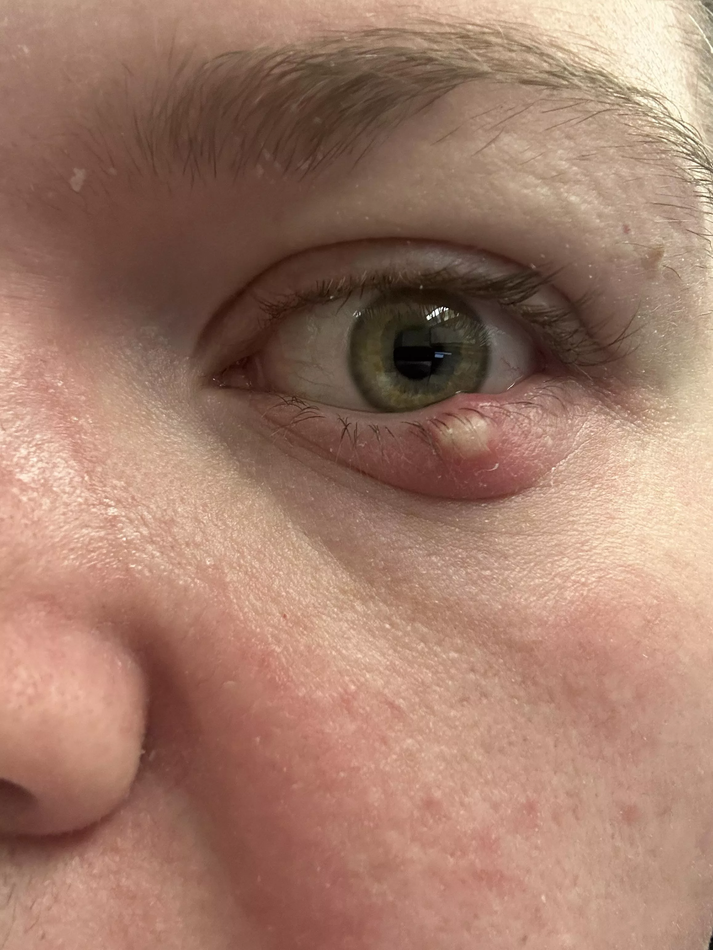 Forbidden Stye Pop!!