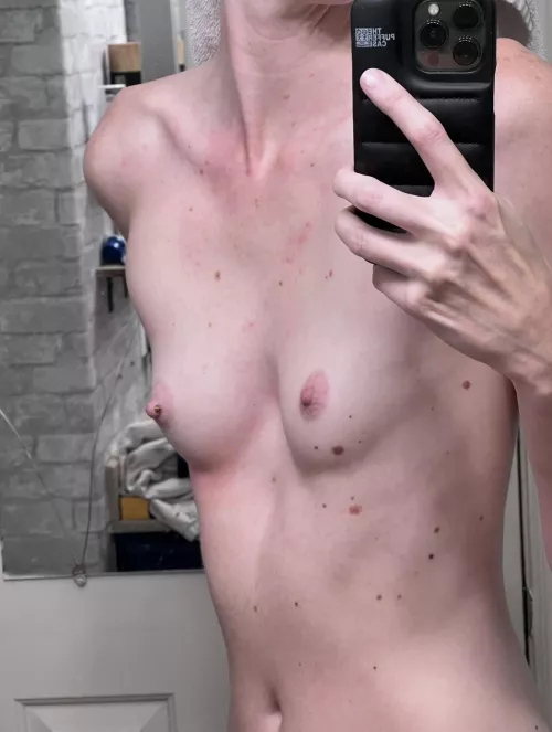 At least I haven’t had to wear a bra in 10 years