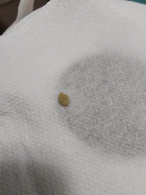Coughed up this stinky little shit
