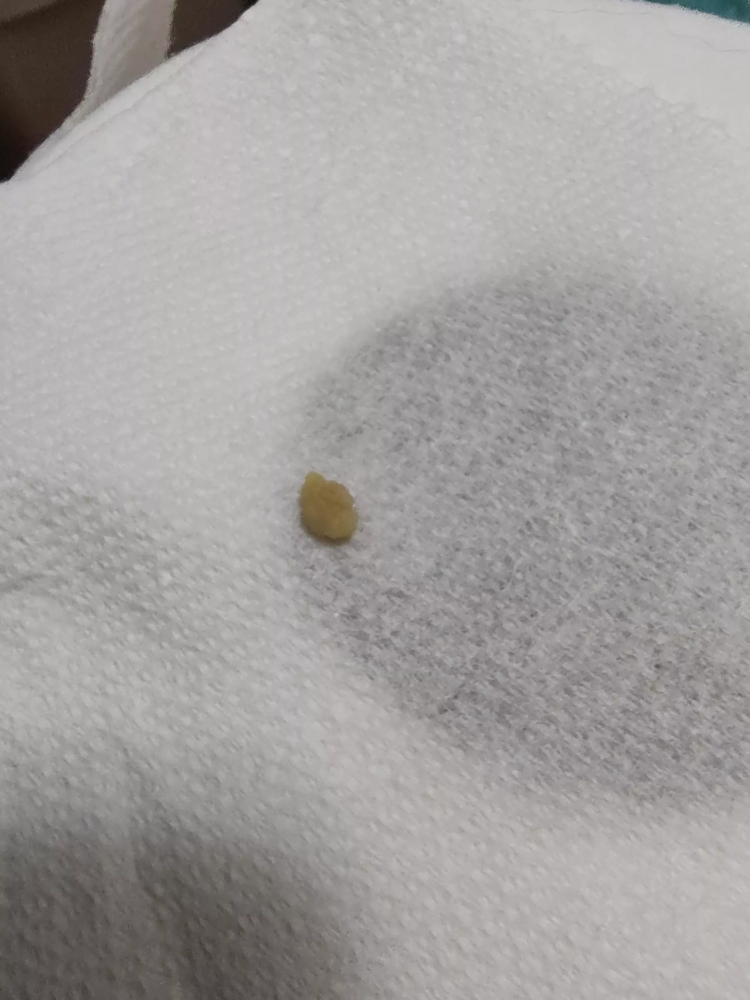 Coughed up this stinky little shit