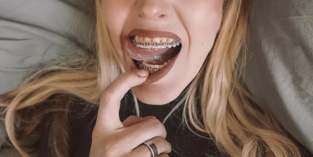 Oops, got a lil’ something stuck in my teeth. Can you get it for me?