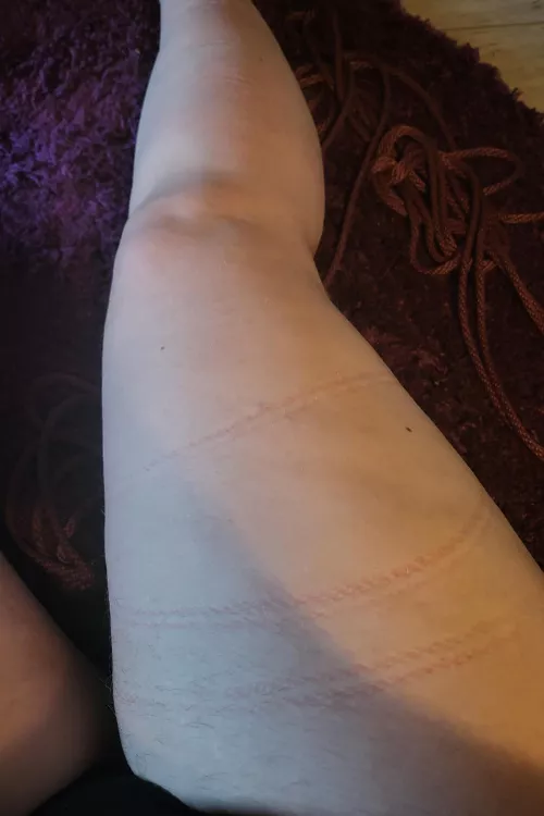 Rope marks are so pretty 