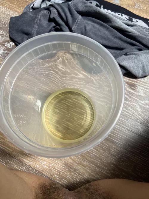 Oh I had an accident 