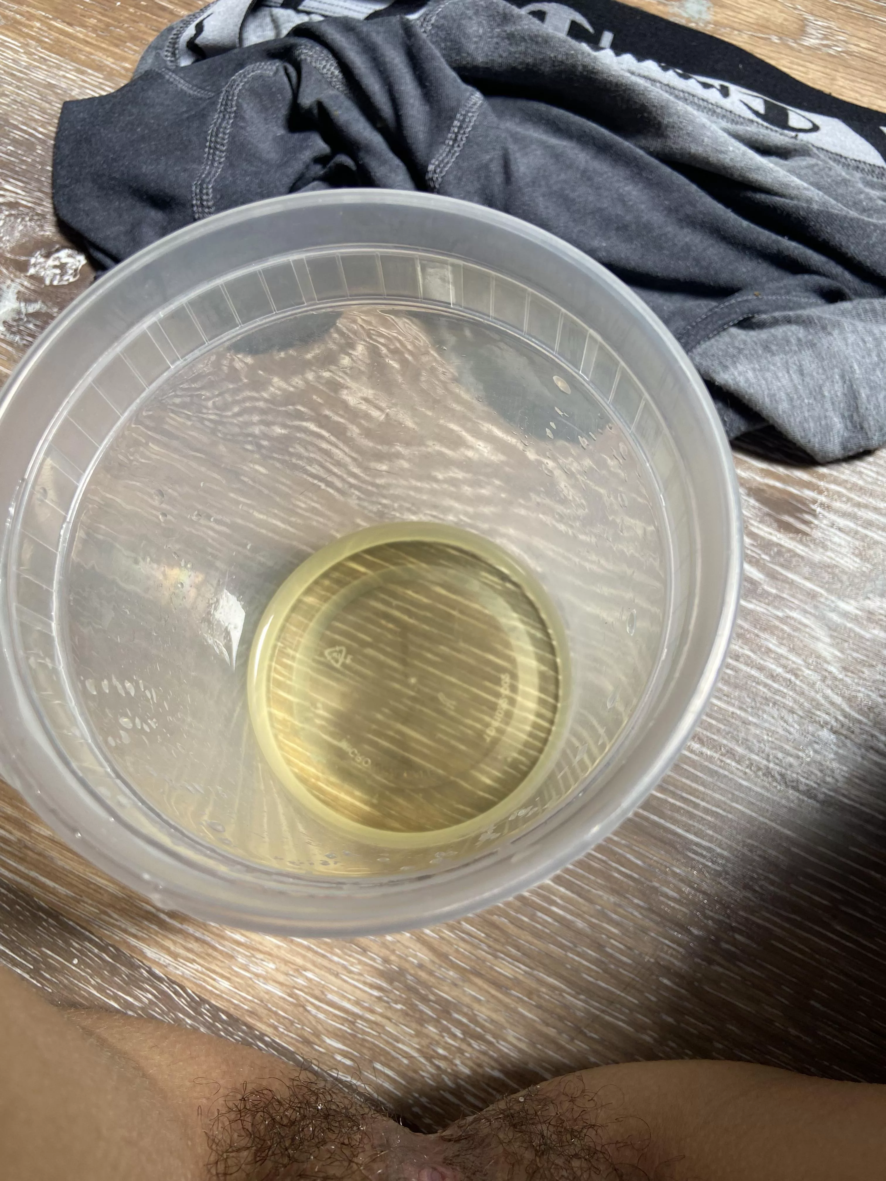 Oh I had an accident 