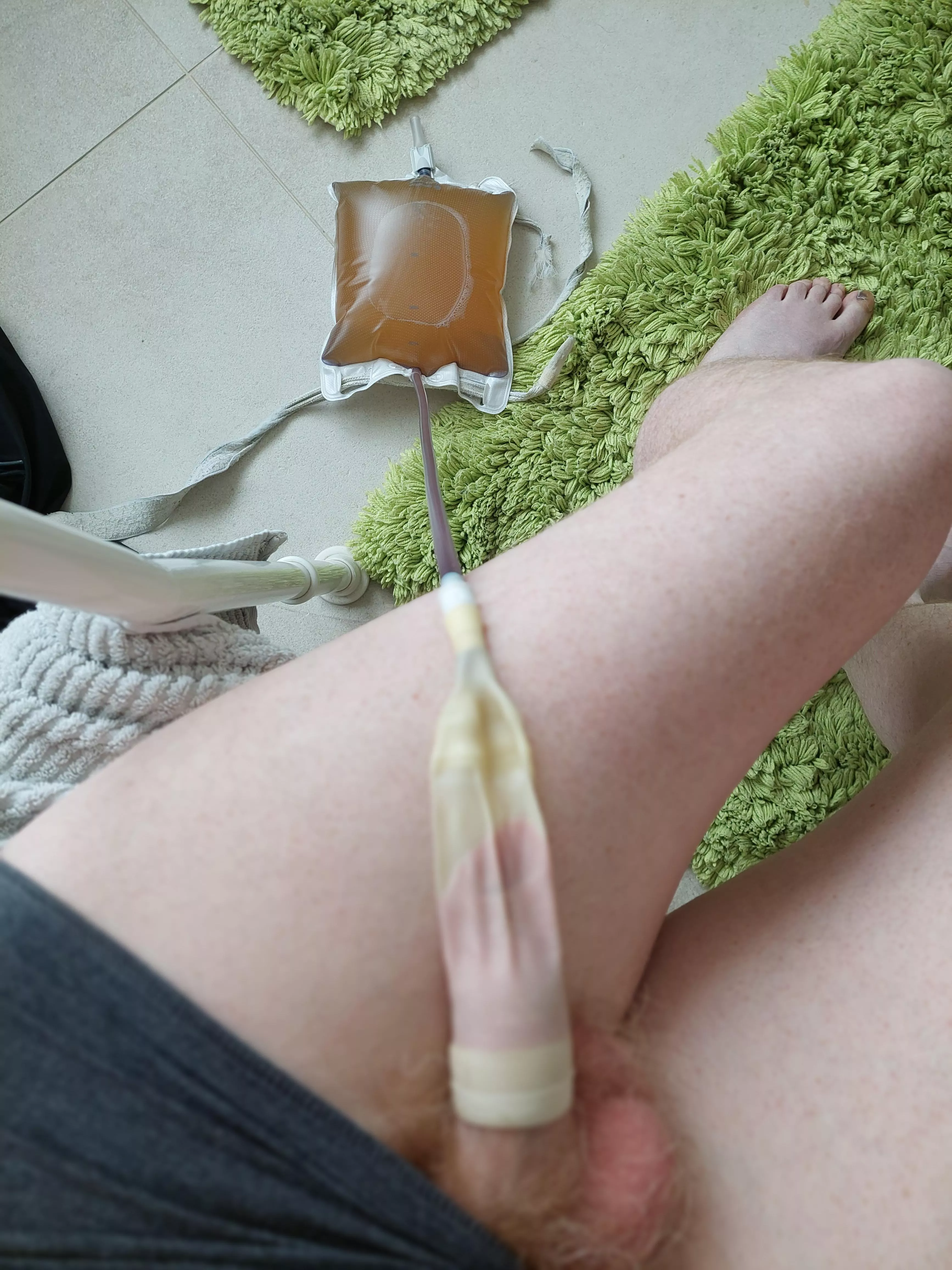 Close to popping my bag 