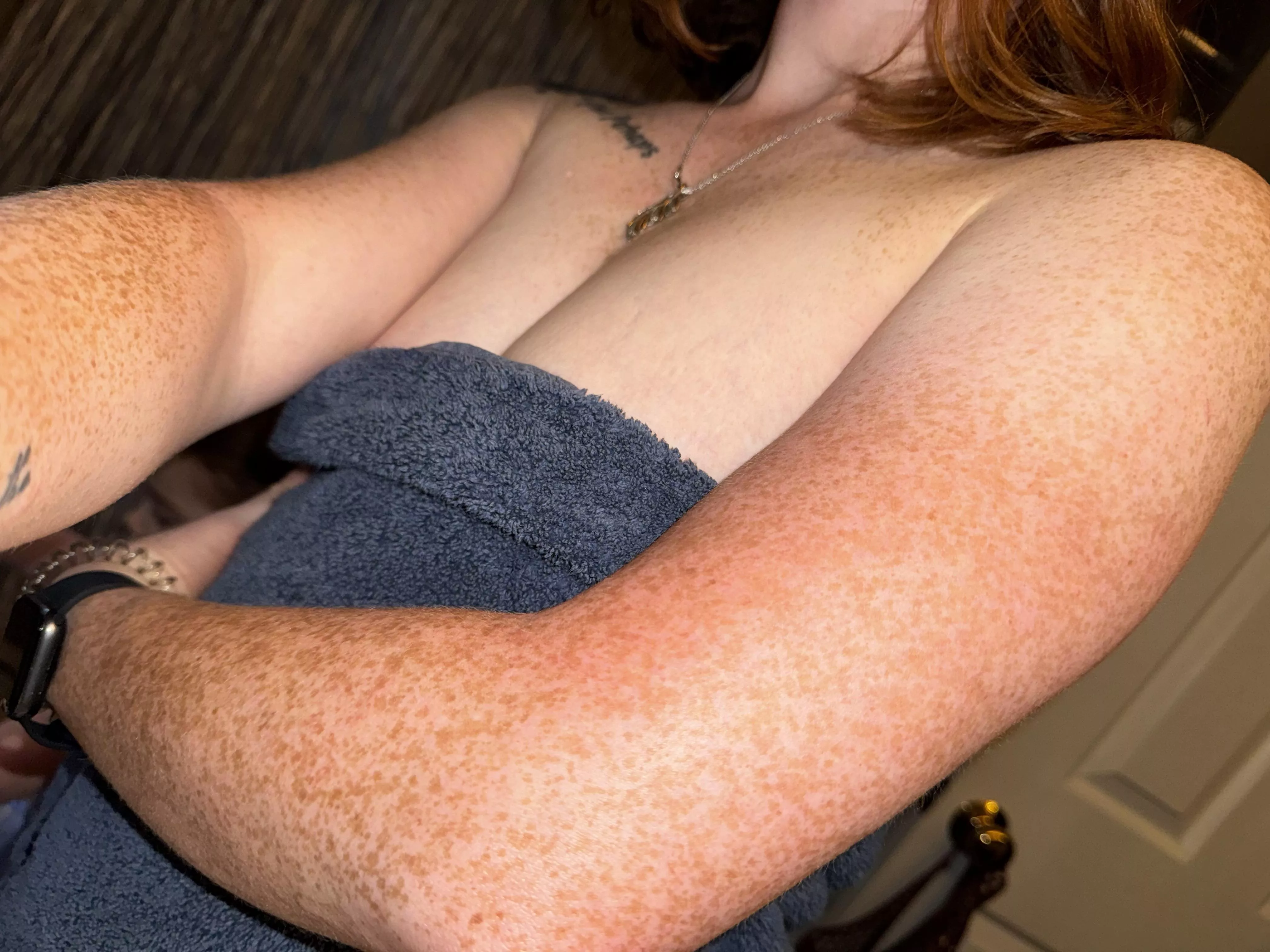 Too many or not enough?[IRTR]