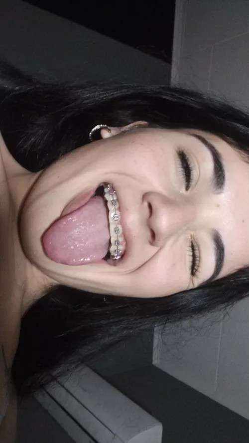 my tongue and my braces look sexy
