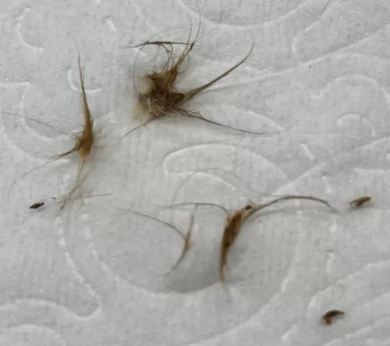 Results of cleaning out my belly button