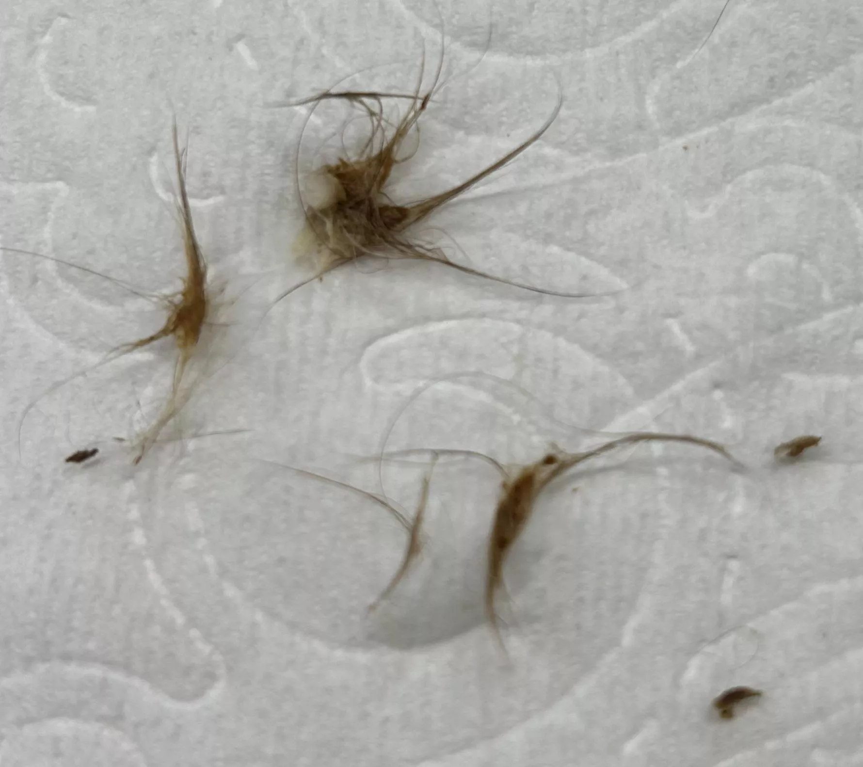 Results of cleaning out my belly button