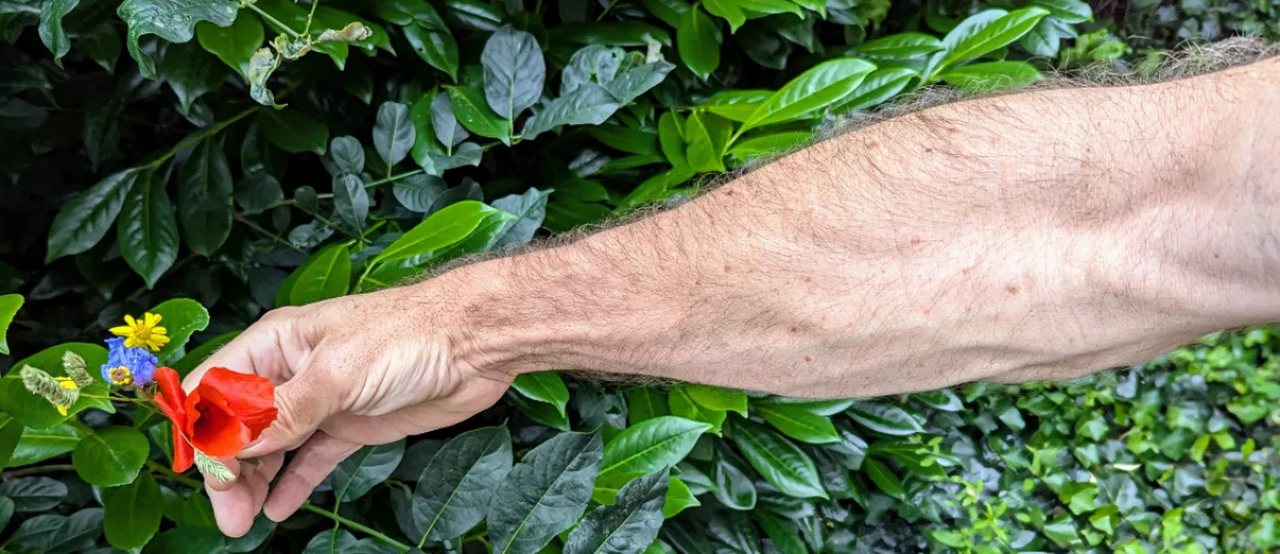 Veins, freckles, hair, what else?