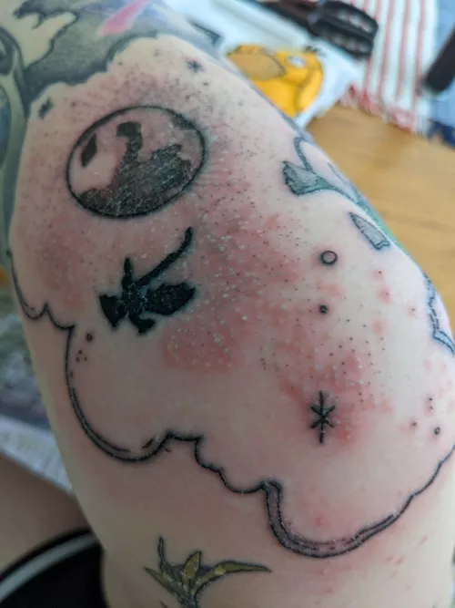 Forbidden pops on knee (ft. Psyduck)