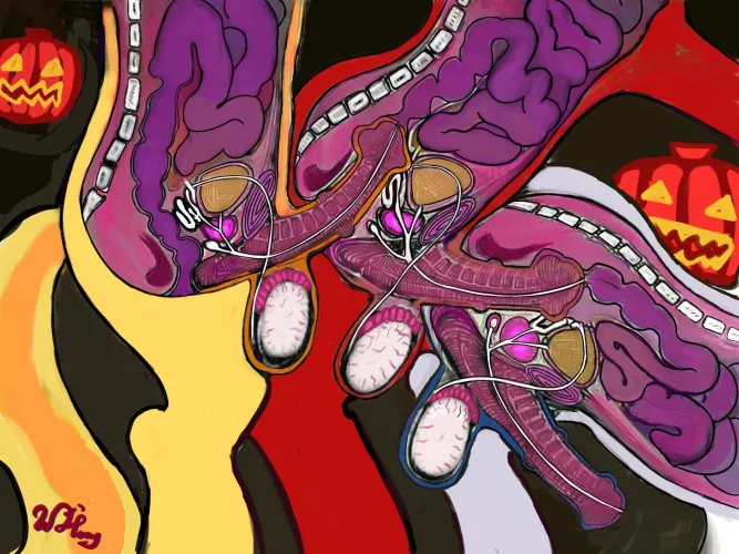 Gay lovetrain X-Ray (artist:ponycor)