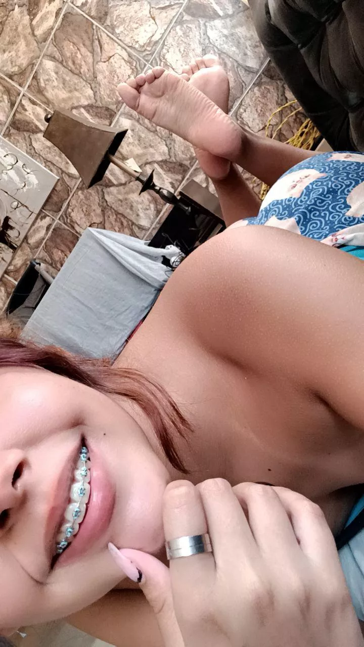 I'm a little comfortable and I like to smile with my braces in front of the camera 