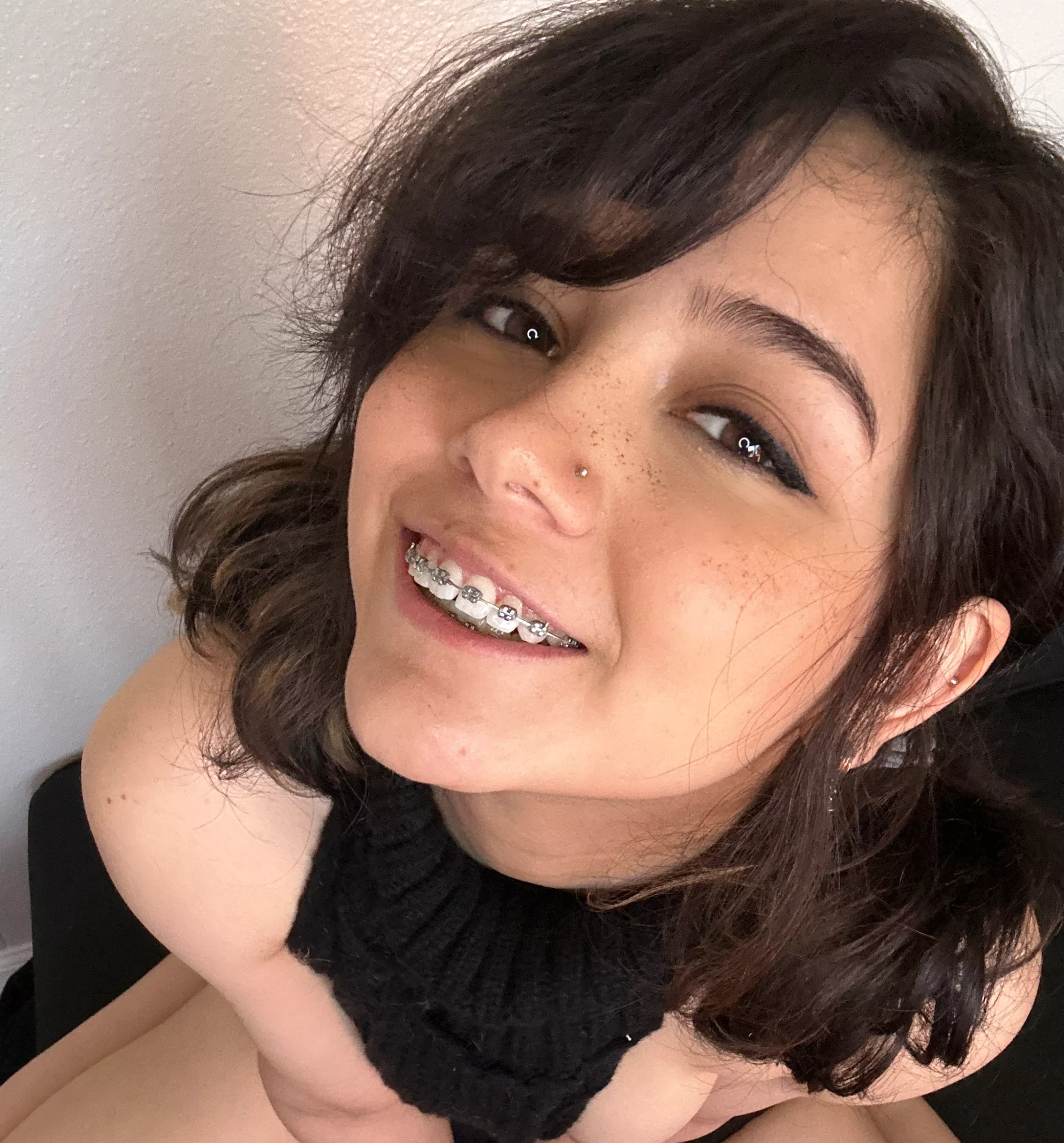 would ya finish my braces?