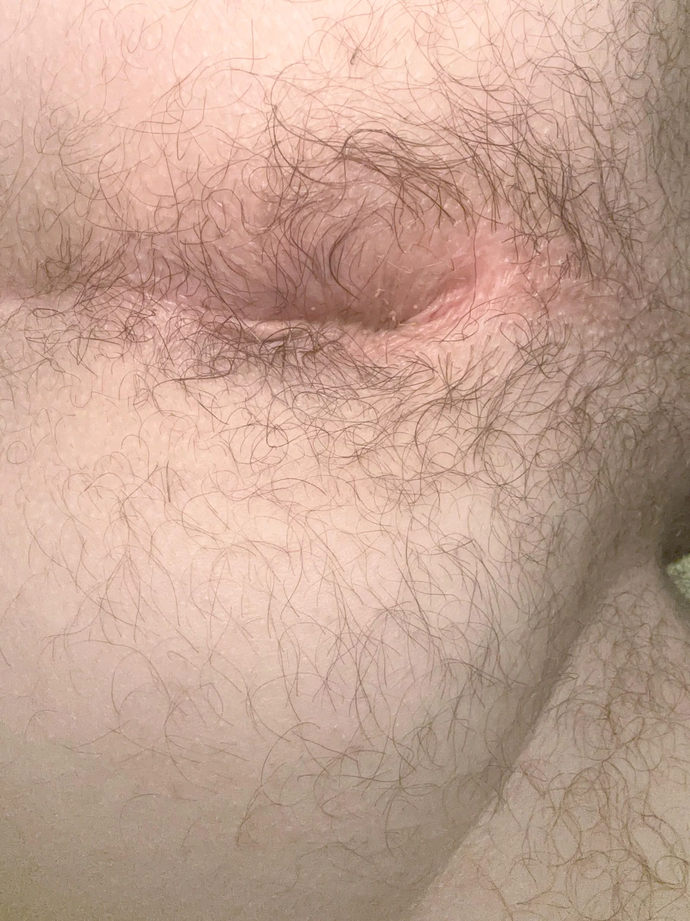 Would you take up the offer?