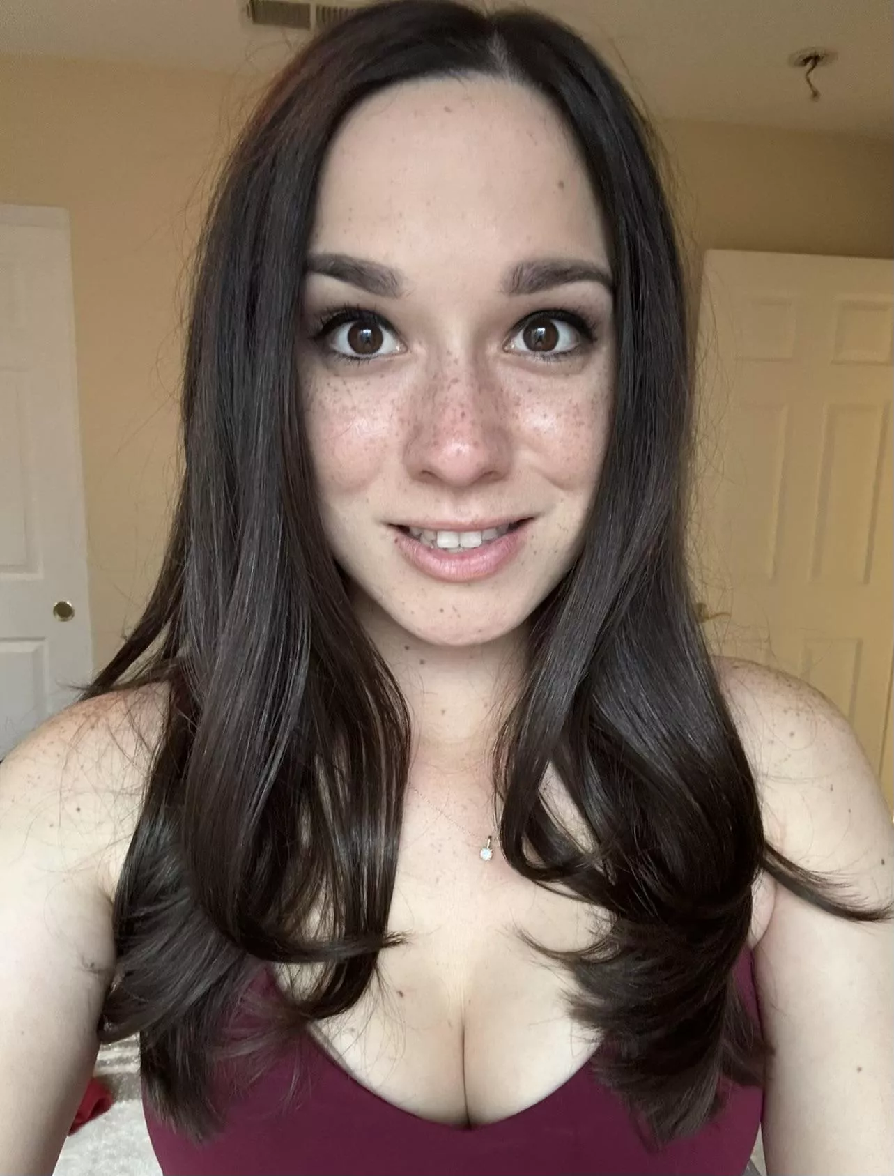 I think I get new freckles everyday.