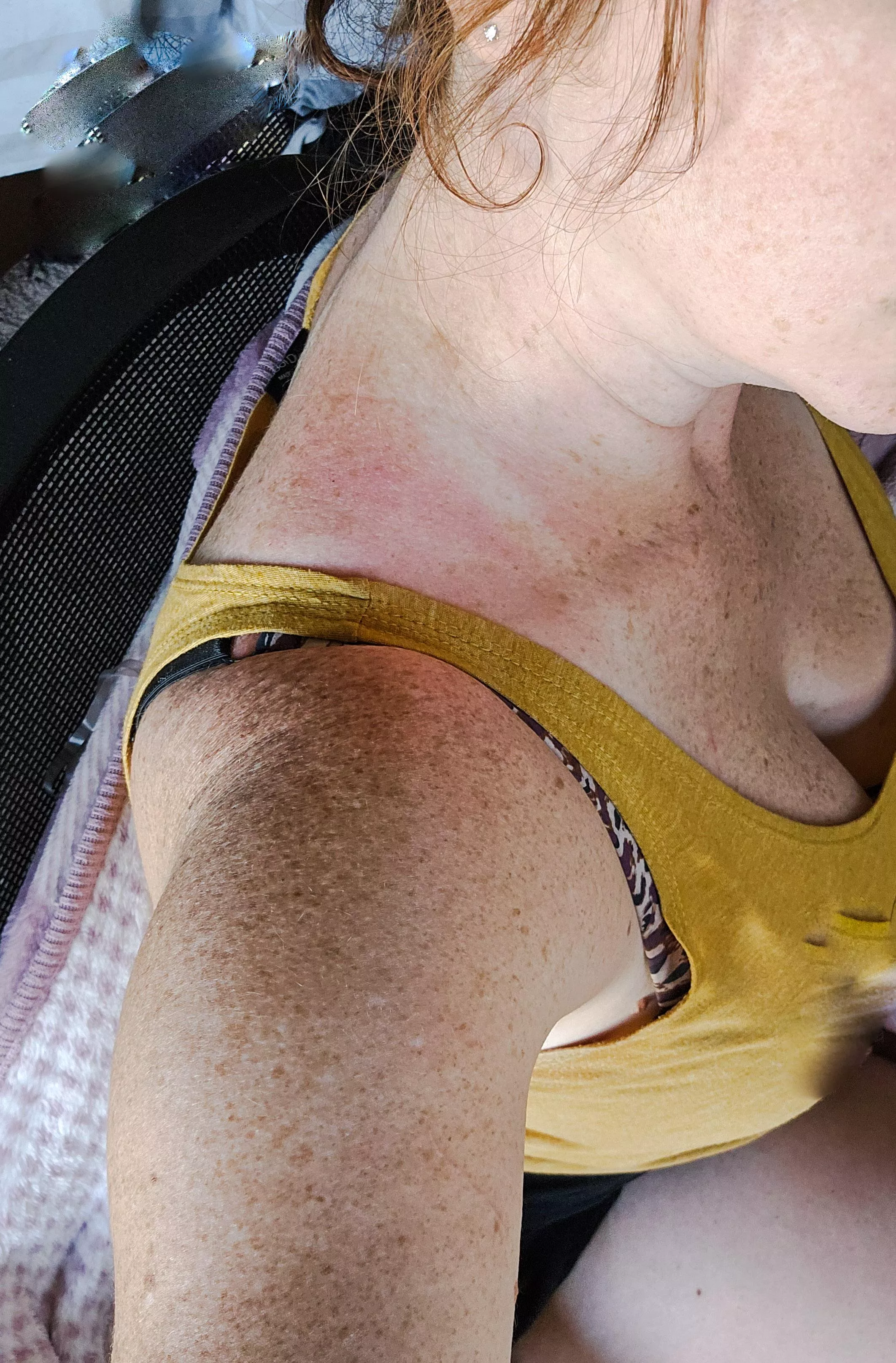 Spent some time outdoors over the weekend = more freckles!! [IRTR]