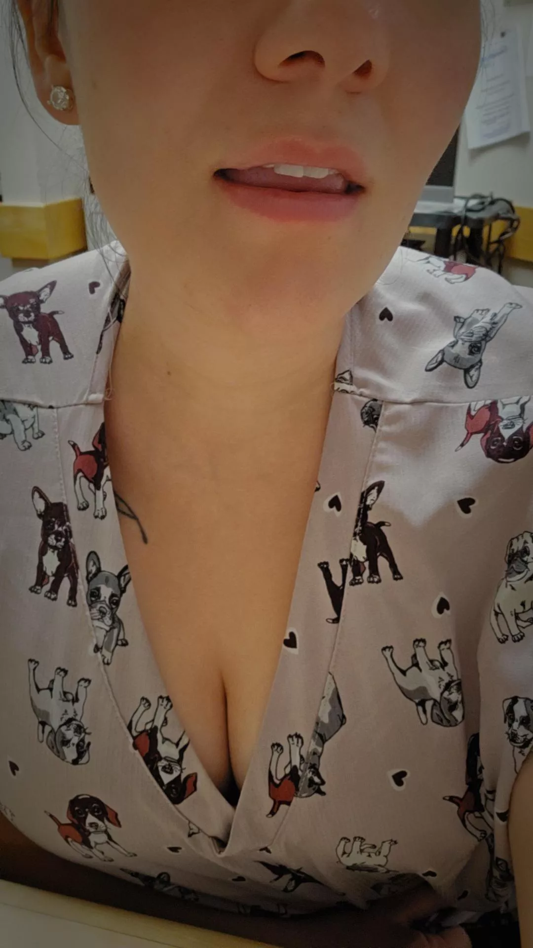 What would you do if I was your nurse?