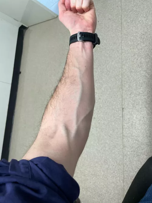 Never had trouble with blood tests 